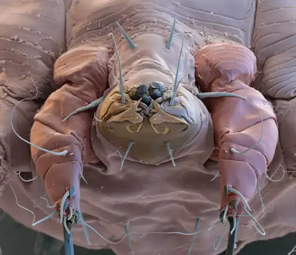 Breakthrough Oral Drug Offers Hope in Global Fight Against Scabies